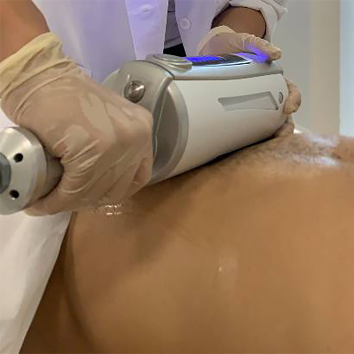 Endosphères therapist applying endospheres therapy to a male patient's abdomen/