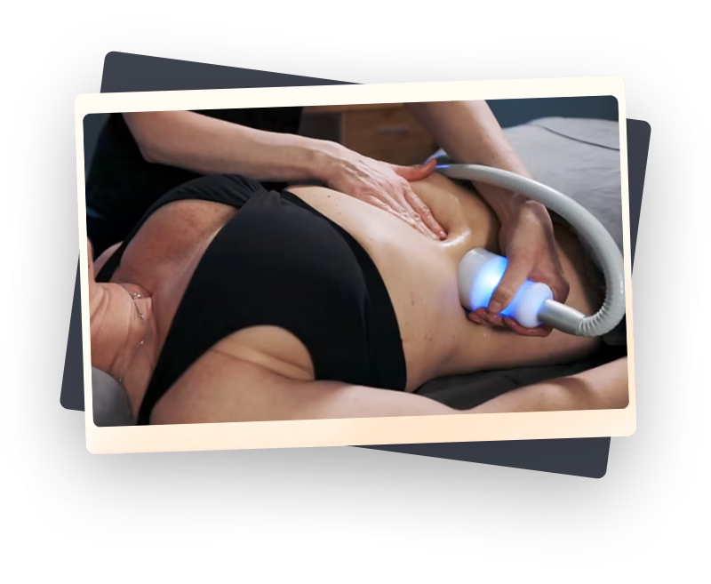 Holly Lange performing a Cryoskin Slimming treatment on a patient in the Bridgewater location.